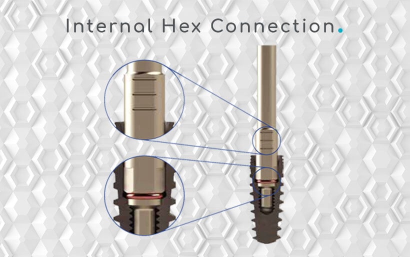 Internal Hex Connection