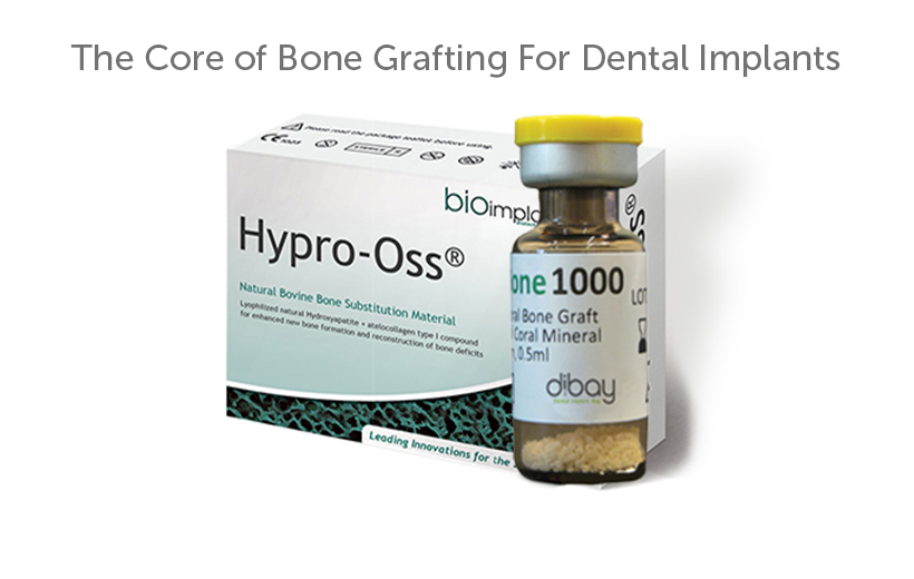 Core Bone Implants
